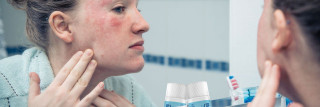 Jesenná skin care rutina pre každého – stop popraskanej a vysušenej pokožke